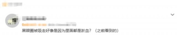 配资代理平台 蚊子叮咬眼睛能吸走黑眼圈和眼袋？来看真相
